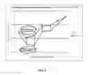 Fig. 06 - Dental implant having enhanced early stability and method for manufacturing same