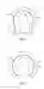 Fig. 02 - Monolithic composite orthopedic implants and associated methods