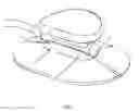 Fig. 09 - Cardiac assist device