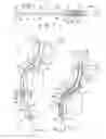 Fig. 02 - Telescopic urinary catheter assemblies