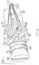 Fig. 26 - Multi-direction steerable handles for steering catheters