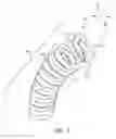 Fig. 08 - Fluid-actuated sheath displacement and articulation behavior improving systems, devices, and methods for catheters, continuum manipulators, and other uses