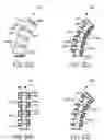 Fig. 22 - Fluid-actuated sheath displacement and articulation behavior improving systems, devices, and methods for catheters, continuum manipulators, and other uses