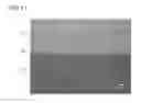 Fig. 12 - Method for producing metal member