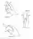 Fig. 19 - Handle and Connector for an Illustration Unit