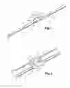 Fig. 02 - WINDSHIELD WIPER-ATTACHMENT DEVICE HAVING A SAFETY POSITION, CONNECTOR AND ADAPTER FOR SUCH A DEVICE, AND WIPING SYSTEM COMPRISING SAID ATTACHMENT DEVICE