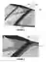 Fig. 02 - Detachable hinge for glass frame