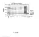 Fig. 06 - QUALITATIVE AND ABSOLUTE QUANTIFICATION KIT FOR DETECTING HEPATITIS B VIRUS CCCDNA