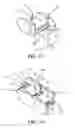 Fig. 10 - CHAIN STRUCTURE FOR SCREEN DEVICE, AND CHAINING UNIT MEMBERS THEREOF