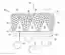 Fig. 01 - Well Screen Design For Enhanced Horizontal Flow Filtration Control