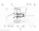 Fig. 01 - Heating device for bearing protection of wind power generator and bearing system