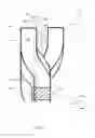 Fig. 07 - Clutch disc with axially expanded spline teeth
