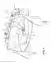 Fig. 06 - Baffle assembly for a charge air cooler