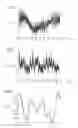 Fig. 05 - Method and apparatus for low-artifact magnetic resonance fingerprinting scan