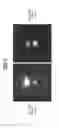 Fig. 06 - Method and apparatus for implementing a turbo spin echo-based reference scan for simultaneous multislice magnetic resonance data acquisitions