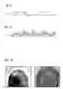 Fig. 06 - Generation of pixel-time series of an examination object by magnetic resonance