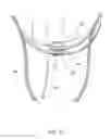 Fig. 11 - Slip-resistant eyewear system