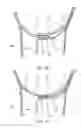 Fig. 25 - Slip-resistant eyewear system