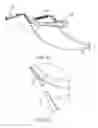 Fig. 57 - Slip-resistant eyewear system