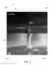 Fig. 07 - Biofeedback virtual reality system and method