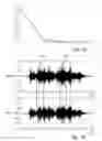 Fig. 08 - Adaptive audio filtering