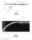 Fig. 07 - Method and apparatus for adjusting a field of a signal to mitigate interference