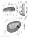 Fig. 41 - Attachment apparatus
