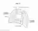 Fig. 18 - Wearable device