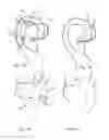Fig. 02 - Hearing device with fixation arrangement