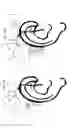 Fig. 08 - Hearing aid device comprising a sensor member