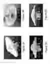 Fig. 04 - Control modules having integral antenna components for luminaires and wireless intelligent lighting systems containing the same