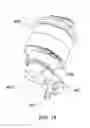 Fig. 19 - Laser Pet Toy and Feeder