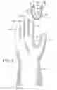 Fig. 03 - Protective device for use with a glove