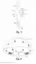 Fig. 03 - WIG CLIP
