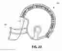 Fig. 59 - Shock Mitigating Materials and Methods Utilizing Sutures