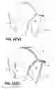 Fig. 64 - Shock Mitigating Materials and Methods Utilizing Sutures