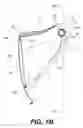Fig. 15 - Helmet