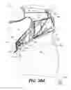 Fig. 44 - Helmet