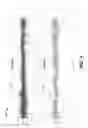 Fig. 06 - DETECTION OF SLEEP DISORDERED BREATHING USING CARDIAC AUTONOMIC RESPONSES
