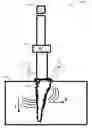 Fig. 01 - Invasive sense measurement in prosthesis installation and bone preparation
