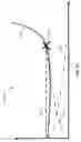 Fig. 16 - Invasive sense measurement in prosthesis installation and bone preparation
