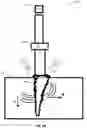 Fig. 34 - Invasive sense measurement in prosthesis installation and bone preparation