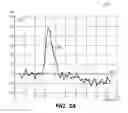 Fig. 04 - Calculation of perfusion parameters in medical imaging