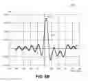 Fig. 09 - Calculation of perfusion parameters in medical imaging