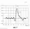 Fig. 10 - Calculation of perfusion parameters in medical imaging