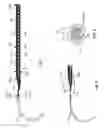 Fig. 02 - Indirect attachment of a needle to a mesh suture