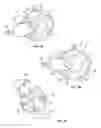 Fig. 05 - Endoscopic surgical systems and methods