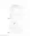 Fig. 02 - Bone fixing system
