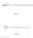 Fig. 03 - Implant and method for long bone fixation