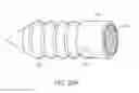 Fig. 28 - Implant and method for long bone fixation